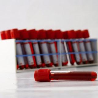 asins analīze bērna transkripcijā